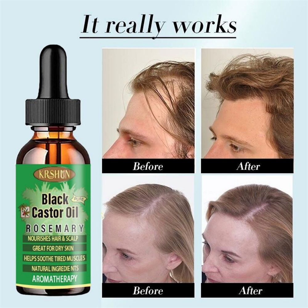 Coconut Oil Pull - Black Castor Oil Nourishes Hair Growth