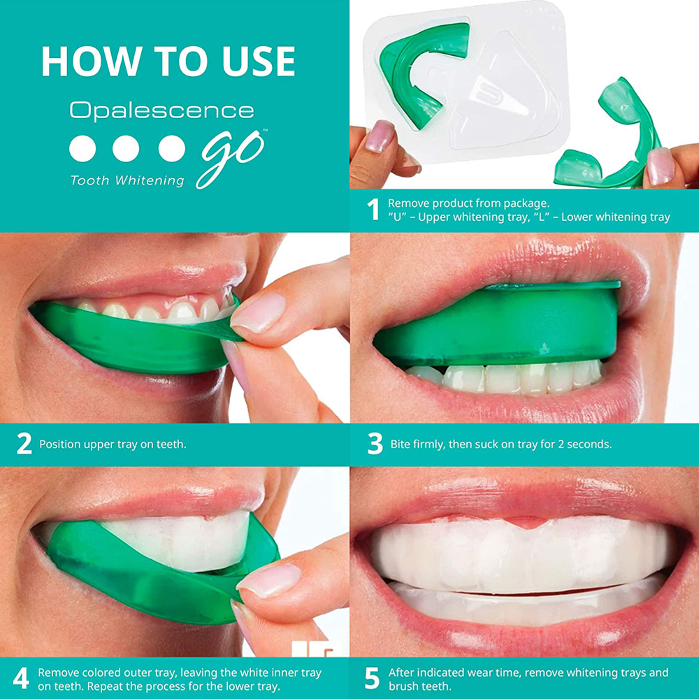Hydrogen Peroxide For Teeth Wh - đánh giá và giá Teeth Whitening In Office