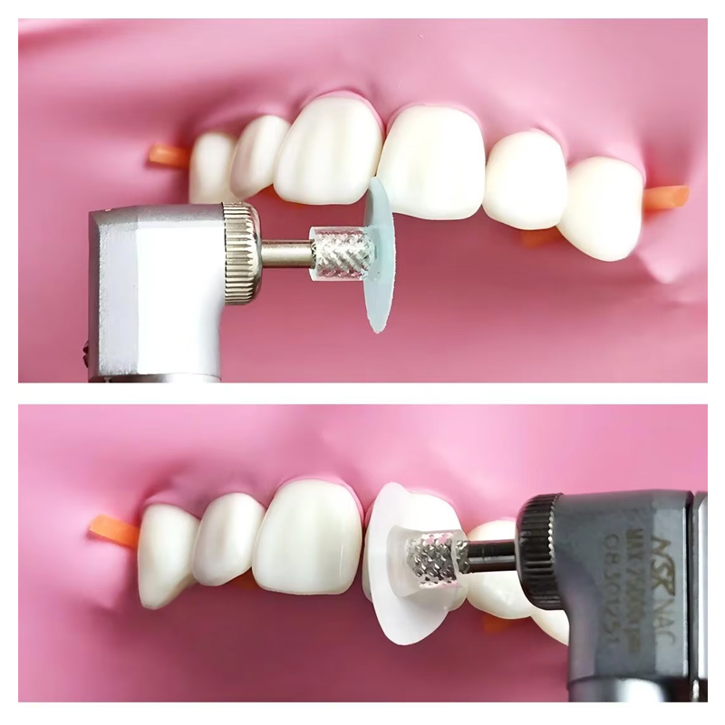 40Pcs Dental Polishing Disc Co - đánh giá và giá Teeth Whitening Express