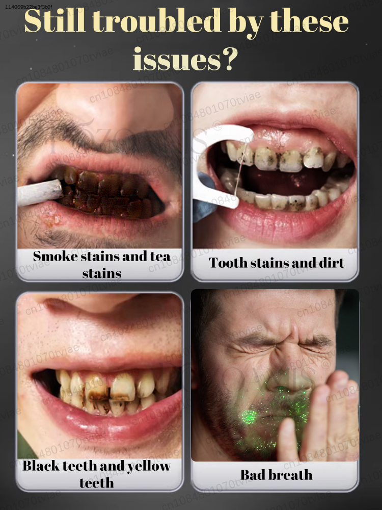 POZOAMIS 30% Hydroxyapatite To - đánh giá và giá Teeth Whitening In Office
