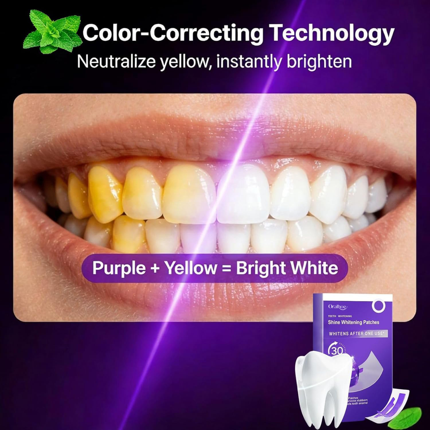 Purple Teeth Whitening Combo K - đánh giá và giá Teeth Whitening In Office