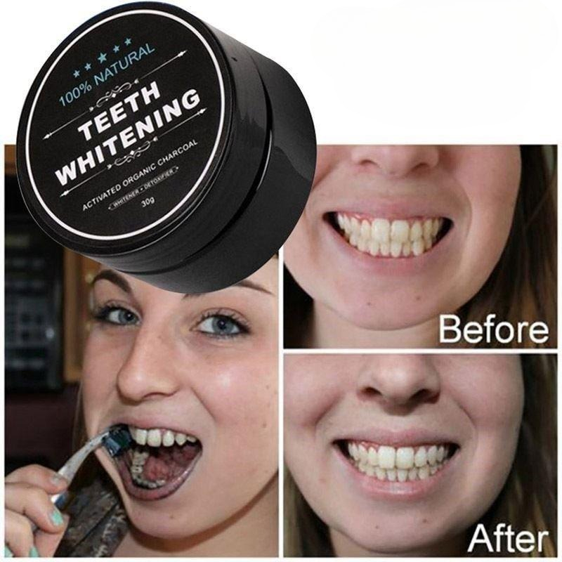 1 Box Activated Charcoal Teeth - đánh giá và giá Whitening Powder Activated