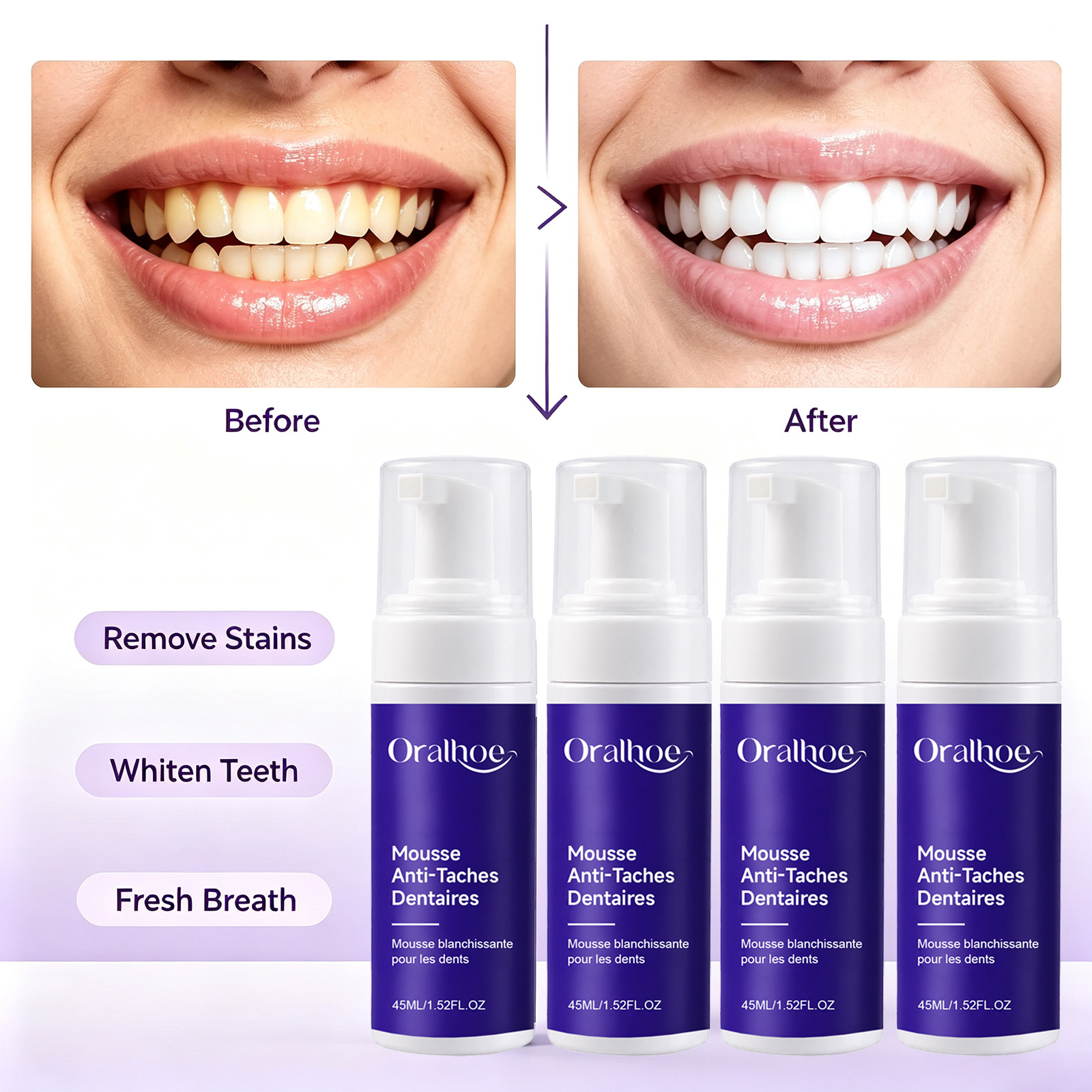 Purple Foaming Teeth Whitening - đánh giá và giá Teeth Whitening Routine