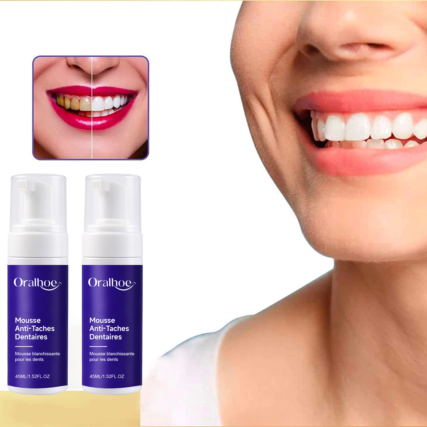 Purple Foaming Teeth Whitening - đánh giá và giá Teeth Whitening Routine