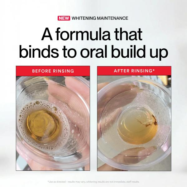Hismile ID Whitening Stain Mou - đánh giá và giá Teeth Whitening Hismile
