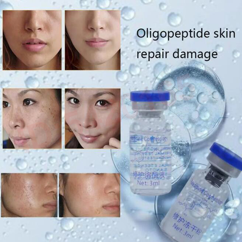 Active Unit EGF Repair Freeze- - đánh giá và giá Whitening Powder Activated