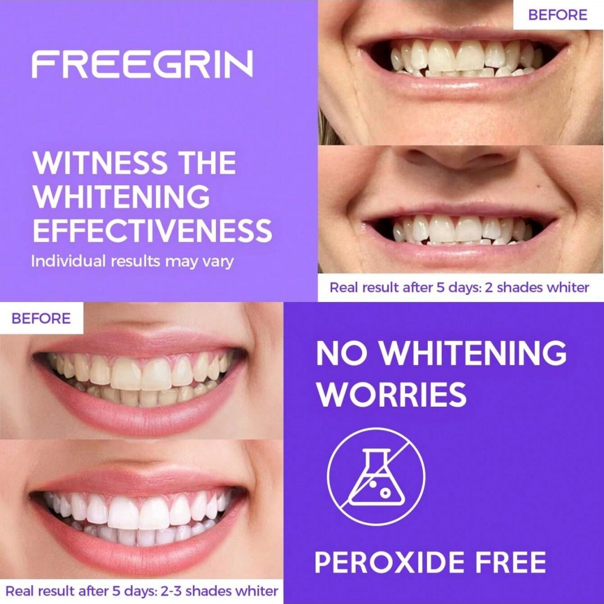 Deluxe Whitening Teeth Sticker - đánh giá và giá Teeth Whitening In Office