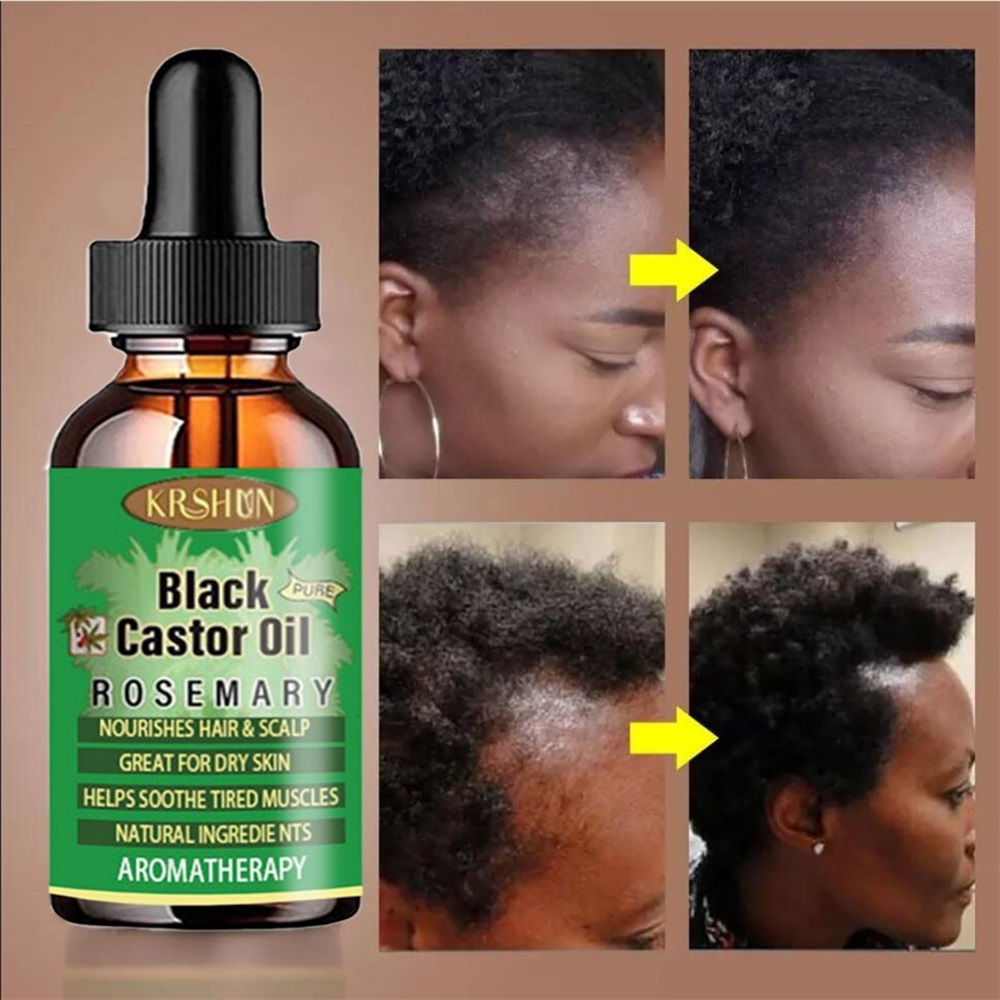 Black Castor Oil Nourishes Hai - đánh giá và giá Coconut Oil Pull
