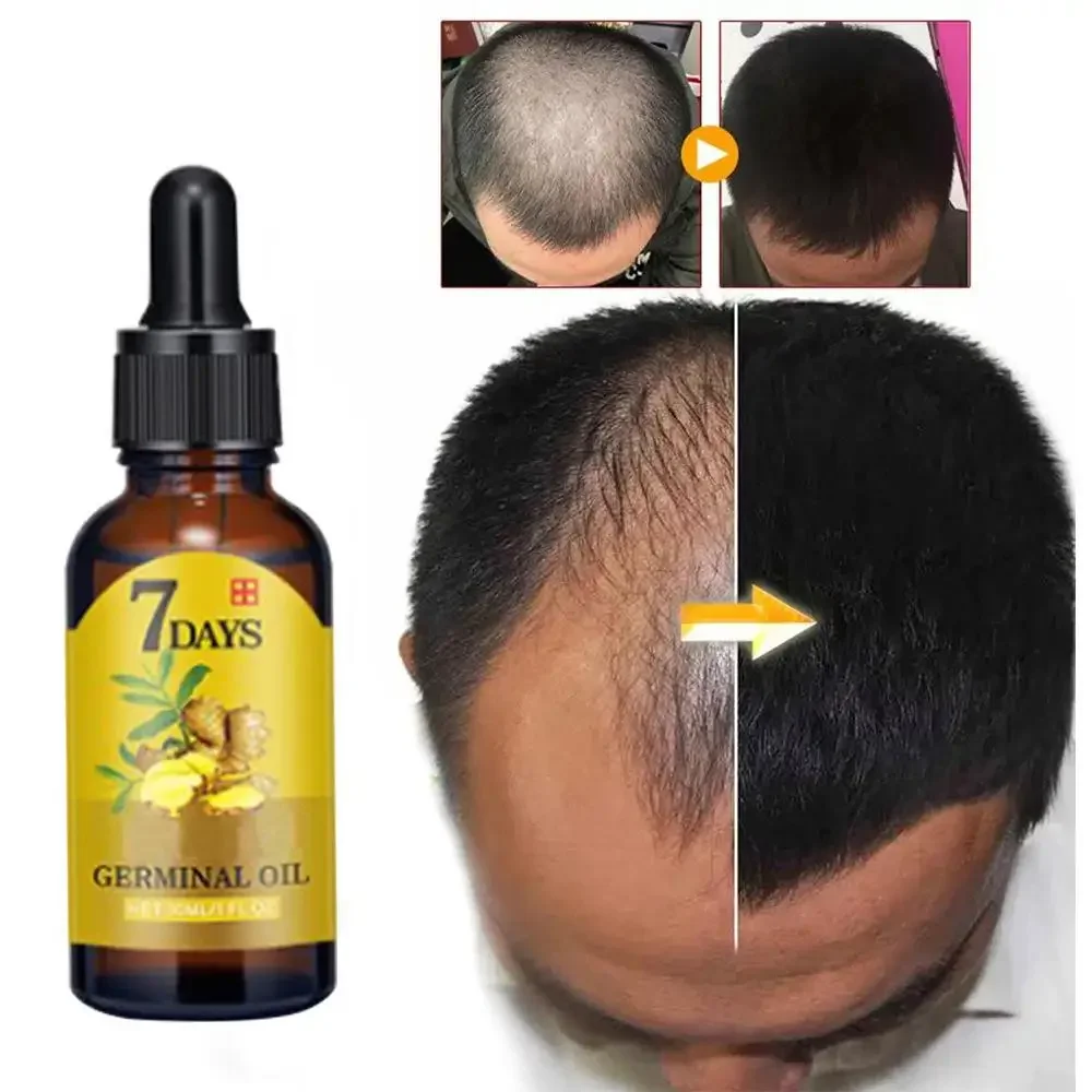 Hair Growth Ginger Fast Growin - đánh giá và giá Coconut Oil Pull