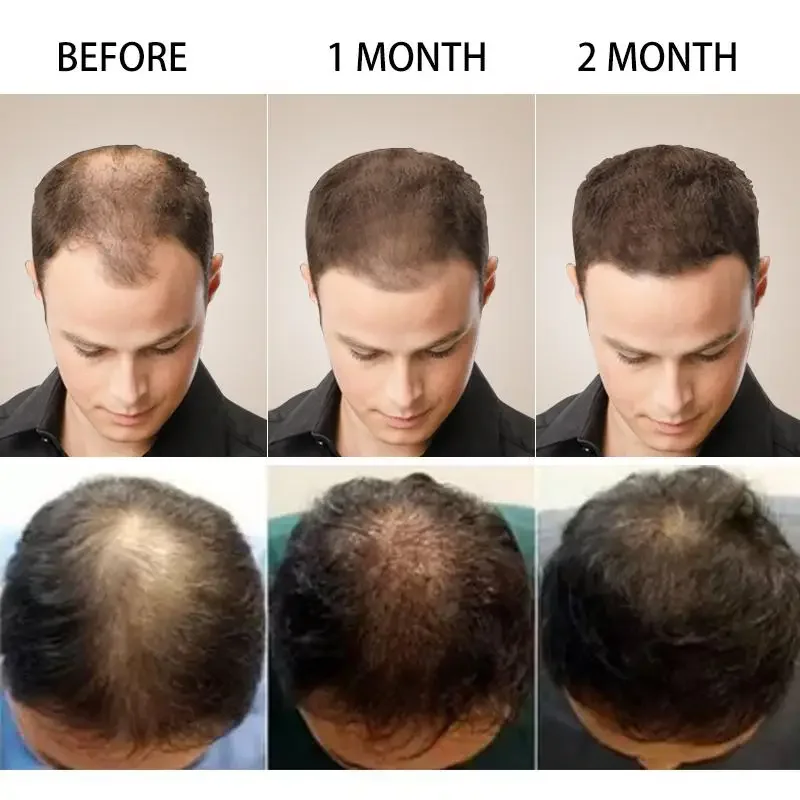 Hair Growth Ginger Fast Growin - đánh giá và giá Coconut Oil Pull