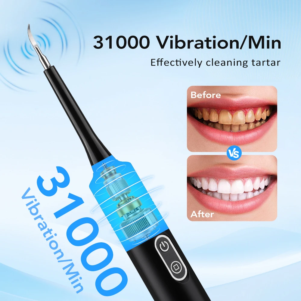Electric Sonic Vibration Denta - đánh giá và giá Teeth Whitening Express