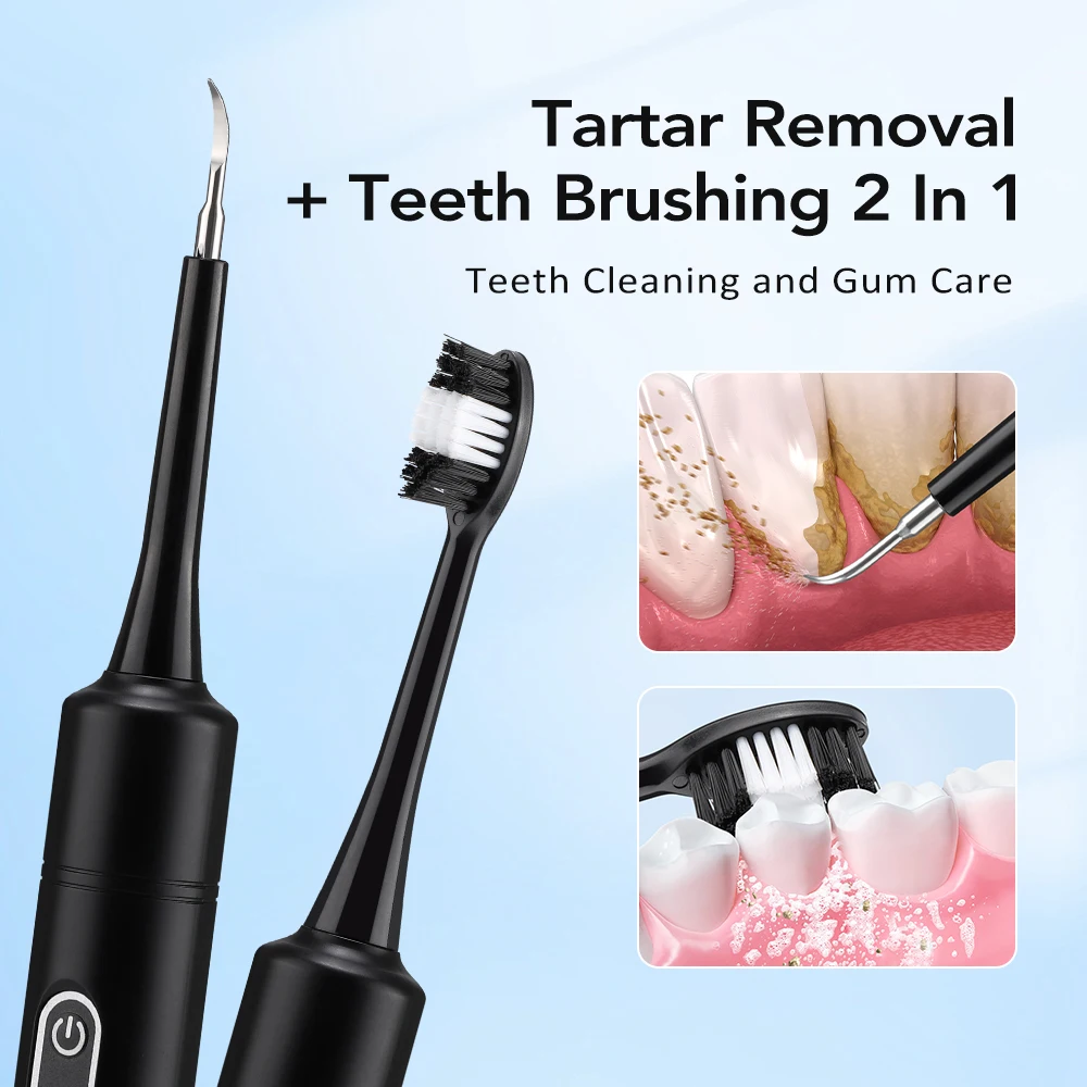 Electric Sonic Vibration Denta - đánh giá và giá Teeth Whitening Express